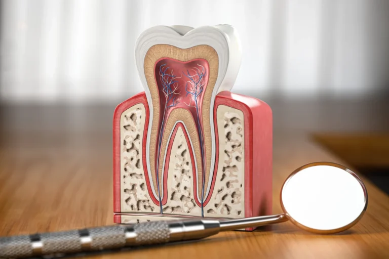 Root Canal Therapy (Endodontics) - Mont Albert Dental Surgery