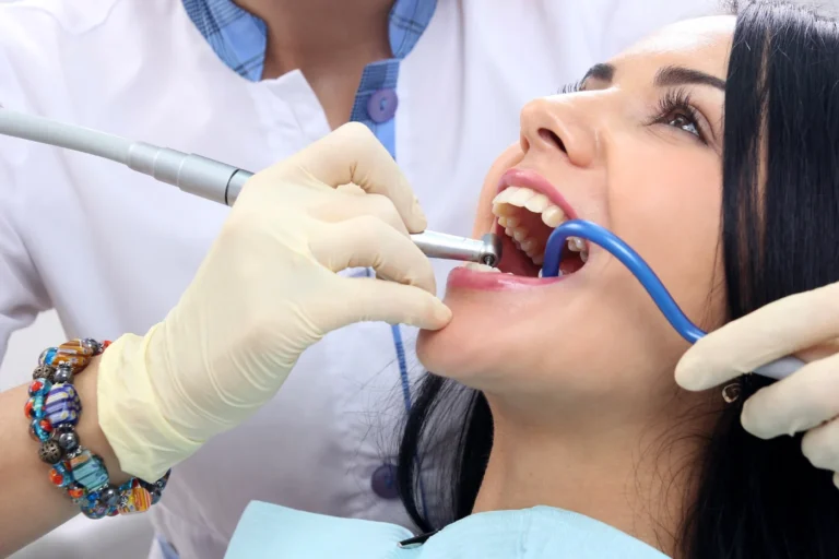 Fillings/Restorations - Mont Albert Dental Surgery